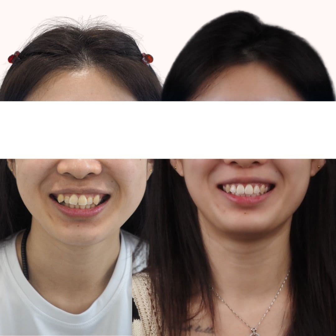 Aloha Dental smile result 2