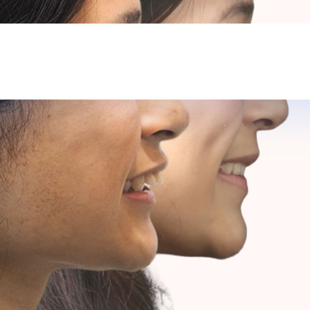 Aloha Dental smile result 1