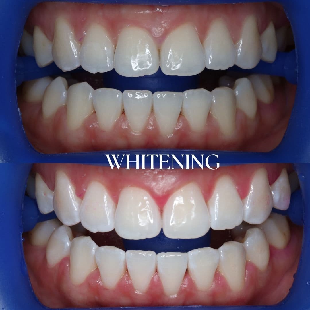 Aloha Dental smile result 6
